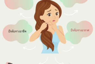 6 ปัจจัยที่ส่งผลกระทบการเกิดสิว